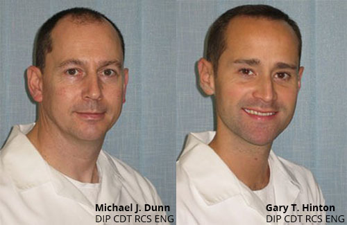 Gary before and after